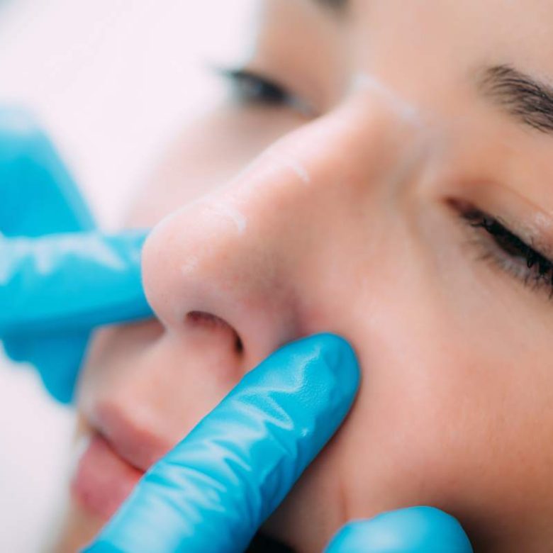 Doctor preparing a dermal filler for treatment of a womans nose.