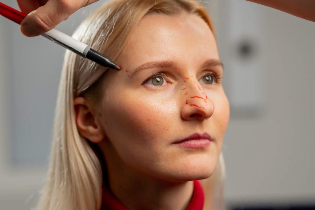 in a plastic surgery clinic doctor makes markings on the face of a young girl before surgery